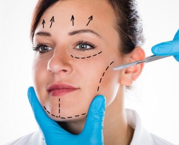 HARMONIZAÇÃO-FACIAL